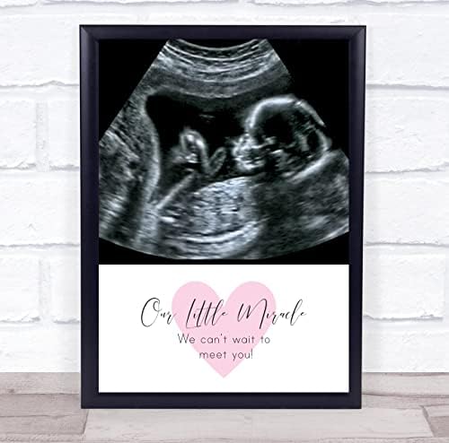 Ултразвуково сканиране на Бременността Бебето Снимка на Нашето Малко Чудо Персонализиран Подарък Принт