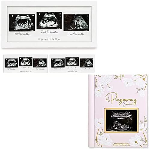 Фоторамка за тройно сонограммы KeaBabies Бебе и Дневник на бременността, Комплект обяви за бременност - Декор на детска, Подаръци за бременни майки (Alpine white) - За всички в?